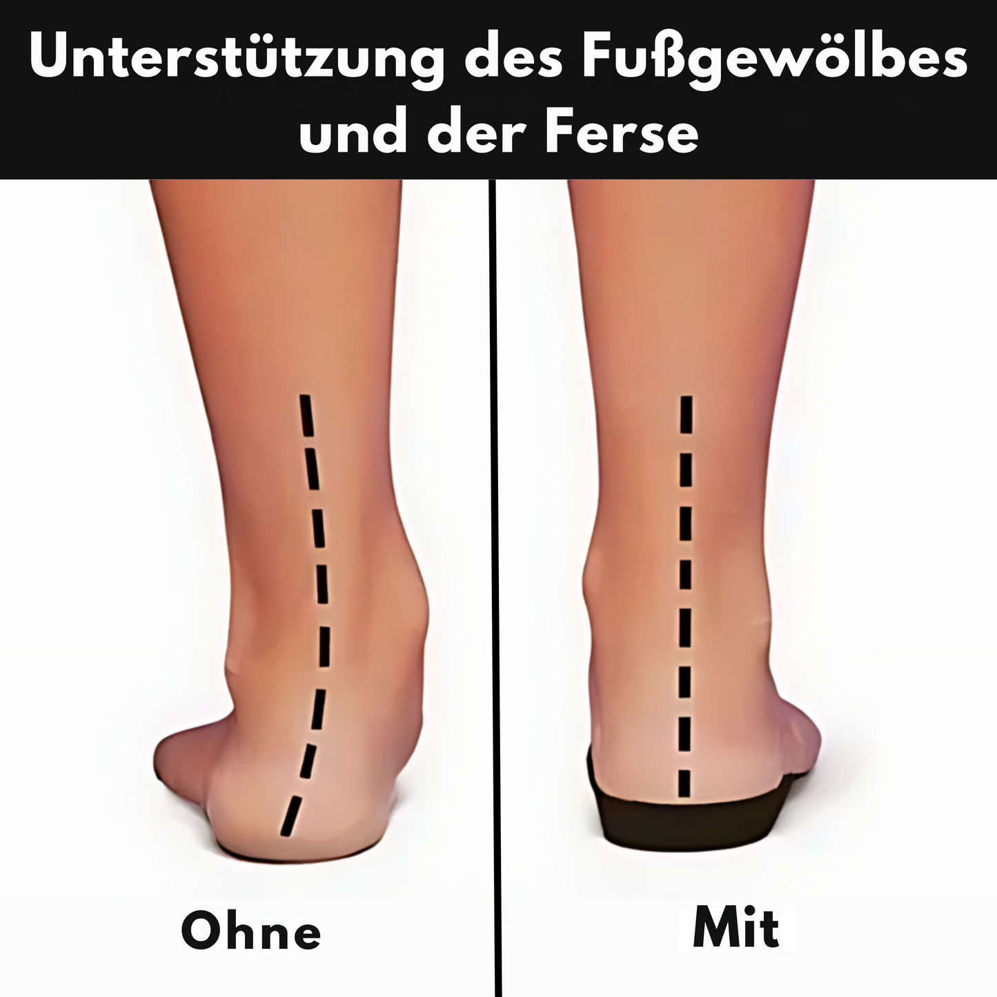 Chaussures Orthopédiques Femme – Confort et Soulagement de la Douleur